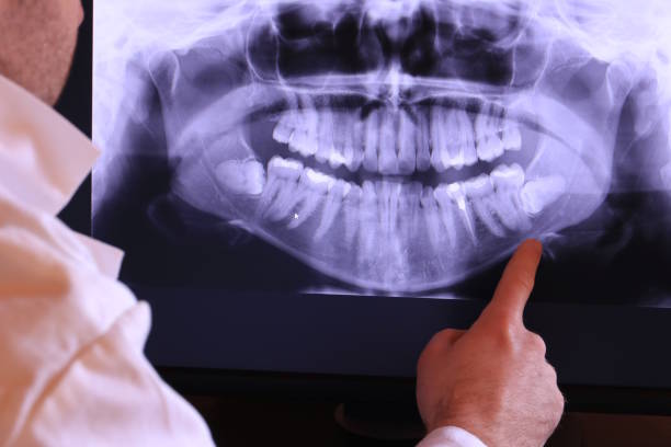 Best Emergency Wisdom Teeth Removal in Dora, AL