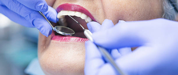 Best Emergency Dental Care for Broken or Chipped Teeth in Dora, AL